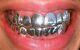 Grillz En Argent Personnalisés En Argent 925 Dans Ce Style Exact Pour Les 8 Dents Du Haut Et Les 8 Dents Du Bas